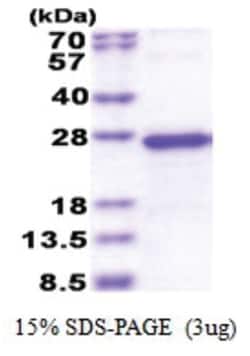 Novus Biologicals Recombinant Human TGIF2LY His Protein 0.5 mg | Buy Online | Novus Biologicals&trade; | Fisher Scientific