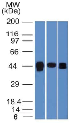 TIA1 Mouse anti-Human, Clone: TIA1/1313, Novus Biologicals 0.2mg; Unlabeled:Antibodies,