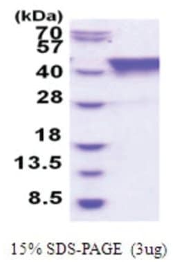 Novus Biologicals&trade;&nbsp;Recombinant Human TIAL1 His Protein