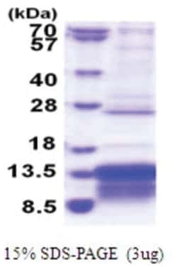 Novus Biologicals&trade;&nbsp;Recombinant Human MUSTN1 His Protein