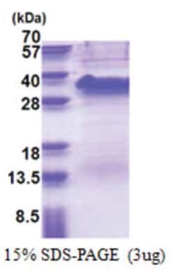 Novus Biologicals Recombinant Human TRAP alpha His Protein 0.02 mg | Buy Online | Novus Biologicals&trade; | Fisher Scientific