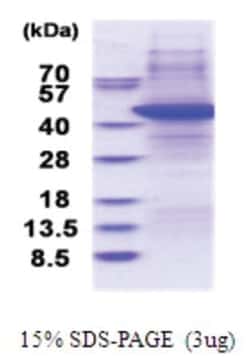 Novus Biologicals Recombinant Human TRBP Protein 0,5 mg | Buy Online | Novus Biologicals&trade; | Fisher Scientific