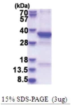 Novus Biologicals&trade;&nbsp;Recombinant Human TSFM Protein