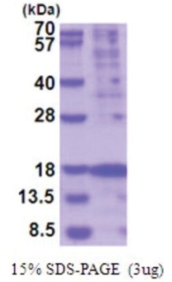 Novus Biologicals&trade;&nbsp;Recombinant Human TSLP His Protein
