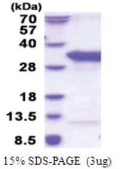 Novus Biologicals&trade;&nbsp;Recombinant Human TSR2 His Protein