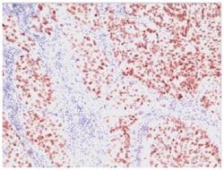 TTF1/NKX2.1 Mouse, Clone: SPM150, Novus Biologicals:Antibodies:Primary