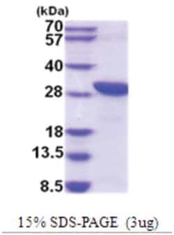 Novus Biologicals&trade;&nbsp;Recombinant Human TWA1 His Protein