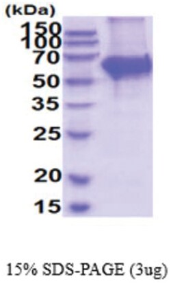 Novus Biologicals&trade;&nbsp;Recombinant Mouse Tyrosine Hydroxylase His Protein