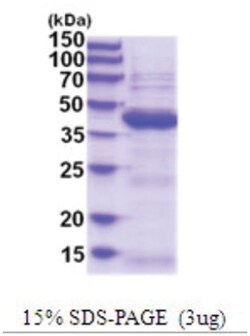 Novus Biologicals&trade;&nbsp;Recombinant Human UBLCP1 His Protein