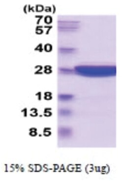 Novus Biologicals&trade;&nbsp;Recombinant Mouse UCH-L3 His Protein
