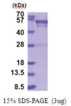 Novus Biologicals&trade;&nbsp;Recombinant Human UGP2 His Protein