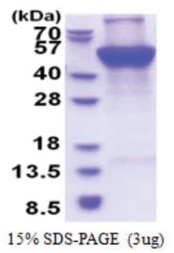 Novus Biologicals&trade;&nbsp;Recombinant Human UQCRC1 His Protein