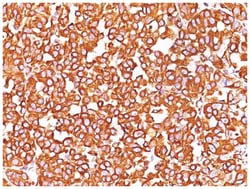 Vimentin Mouse, Clone: SPM576, Novus Biologicals 0.2mg; Unlabeled:Antibodies,