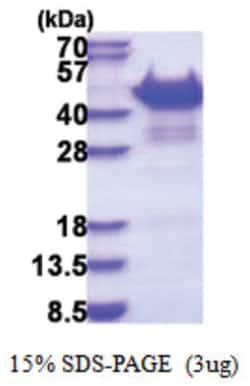 Novus Biologicals&trade;&nbsp;Recombinant Human Vinexin His Protein