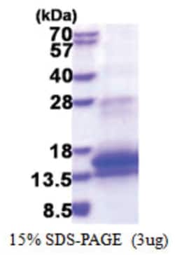 Novus Biologicals&trade;&nbsp;Recombinant Human WFDC12 His Protein