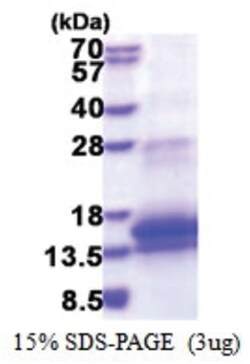 Novus Biologicals Recombinant Human WFDC12 His Protein 0.5 mg | Buy Online | Novus Biologicals&trade; | Fisher Scientific