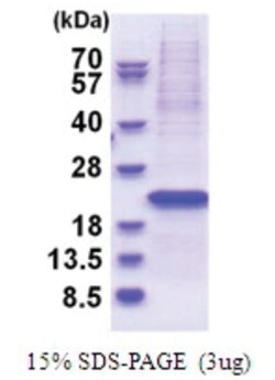 Novus Biologicals&trade;&nbsp;Recombinant Human YIF1B His Protein