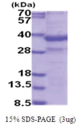 Novus Biologicals&trade;&nbsp;Recombinant Human ZAG His Protein