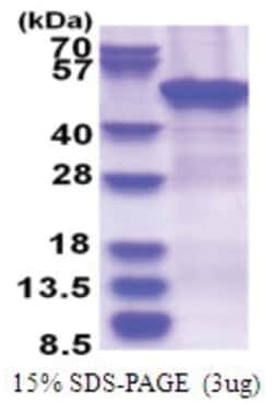 Novus Biologicals&trade;&nbsp;Recombinant Human ZCCHC12 His Protein