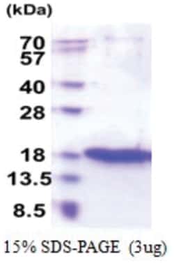 Novus Biologicals&trade;&nbsp;Recombinant Human ZG16 His Protein