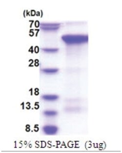 Novus Biologicals Recombinant Human Zhangfei His Protein 0,05 mg | Buy Online | Novus Biologicals&trade; | Fisher Scientific