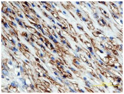 Human/Mouse/Rat alpha-Smooth Muscle Actin Antibody, R D Systems 25&mu;g;