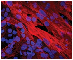 Human/Mouse/Rat alpha-Smooth Muscle Actin Antibody, R D Systems 25&mu;g;