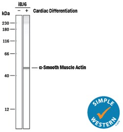 Human/Mouse/Rat alpha-Smooth Muscle Actin Antibody, R D Systems 25&mu;g;