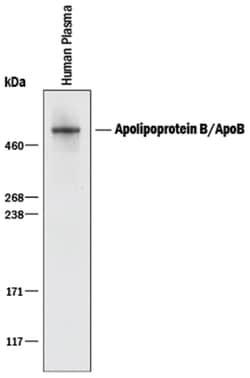 Human Apolipoprotein B100/ApoB100 Antibody, R D Systems 25&mu;g; Unlabeled:Antibodies,