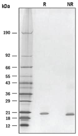 R D Systems Recombinant Mouse BAFF/BLyS/TNFSF13B Protein 10 &mu;g | Buy Online | R&amp;D Systems&trade; | Fisher Scientific
