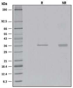 R D Systems Recombinant Human CTRP4/C1qTNF4 Protein 50ug; Carrier Free | Buy Online | R&amp;D Systems&trade; | Fisher Scientific