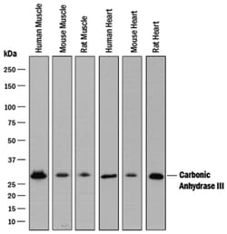 Human/Mouse/Rat Carbonic Anhydrase III/CA3 Antibody, R D Systems 25&mu;g;