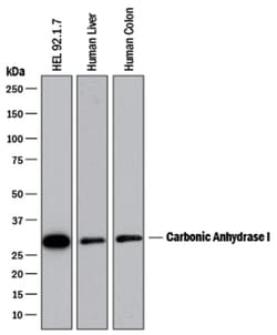 Human Carbonic Anhydrase I/CA1 Antibody, R D Systems 25&mu;g; Unlabeled:Antibodies,