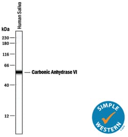 Human Carbonic Anhydrase VI Antibody, R D Systems 25 &mu;g | Buy Online | R&D Systems | Fisher Scientific
