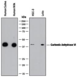 Human Carbonic Anhydrase VI Antibody, R D Systems 25 &mu;g | Buy Online | R&D Systems | Fisher Scientific