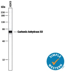 Human Carbonic Anhydrase XII/CA12 Antibody, R D Systems 25&mu;g; Unlabeled:Antibodies,