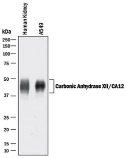Human Carbonic Anhydrase XII/CA12 Antibody, R D Systems 25&mu;g; Unlabeled:Antibodies,