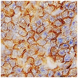 Human TMIGD2/CD28H Antibody, R D Systems:Antibodies:Primary Antibodies
