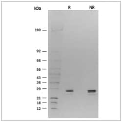 R&D Systems&trade;&nbsp;Recombinant Rat CD40 Ligand/TNFSF5 (HA-tag) Protein