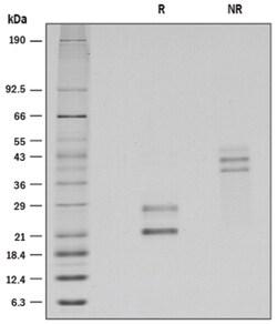 R&D Systems&trade;&nbsp;Recombinant Human CD69 Protein