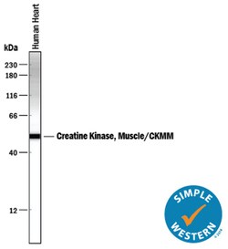 Human Creatine Kinase MM/CKMM Antibody, R D Systems 25&mu;g; Unlabeled:Antibodies,