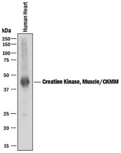 Human Creatine Kinase MM/CKMM Antibody, R D Systems 25&mu;g; Unlabeled:Antibodies,