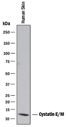 Human Cystatin E/M Antibody, R D Systems 100&mu;g; Unlabeled:Antibodies,