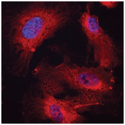 Human DARC Antibody, R D Systems 100ug; Unlabeled:Antibodies, Monoclonal
