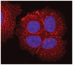 Human Desmoglein-2 Biotinylated Antibody, R D Systems 50&mu;g; Biotin:Antibodies,