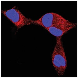 Human Endothelin-3 Antibody, R D Systems 25&mu;g; Unlabeled:Antibodies,