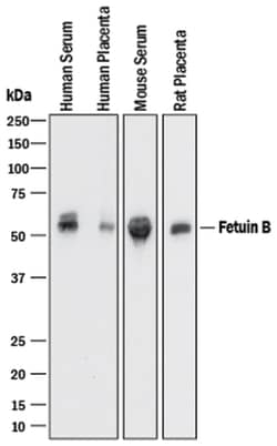 Human/Mouse/Rat Fetuin B Antibody, R D Systems 25&mu;g; Unlabeled:Antibodies,
