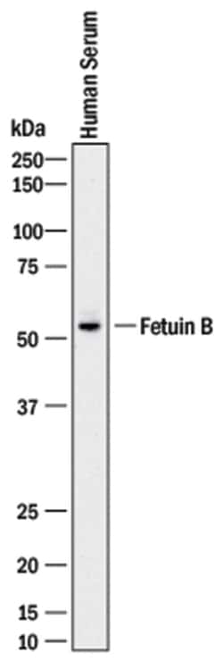 Human Fetuin B Antibody, R D Systems 500ug; Unlabeled:Antibodies, Monoclonal