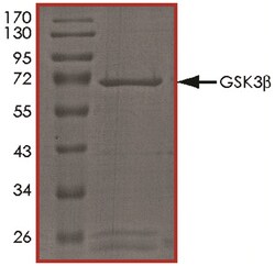 R D Systems Recombinant Human Active GSK-3 beta Protein 10ug, Carrier Free | Buy Online | R&amp;D Systems&trade; | Fisher Scientific