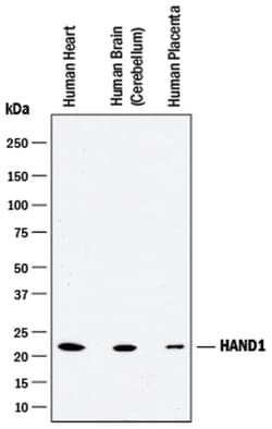 Human HAND1 Antibody, R D Systems 100&mu;g; Unlabeled:Antibodies, Polyclonal